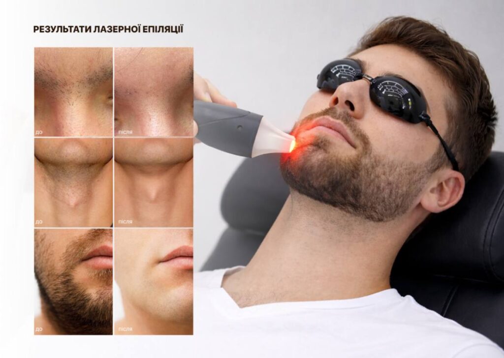 Діодний лазер для видалення волосся для барберів - BARBERLUX DIODE