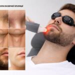 Діодний лазер для видалення волосся для барберів - BARBERLUX DIODE